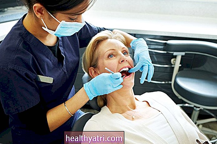 3 alergijos, kurias galima sukelti pas odontologą