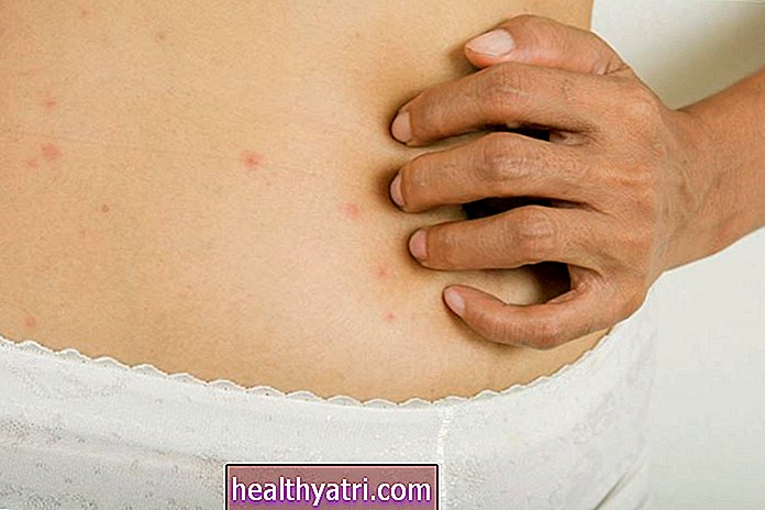 Алергічні реакції під час статевого акту