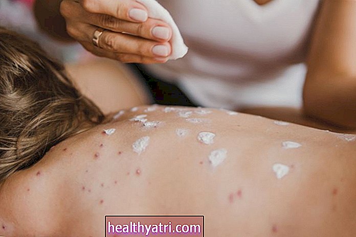 Преглед алергија на кожи