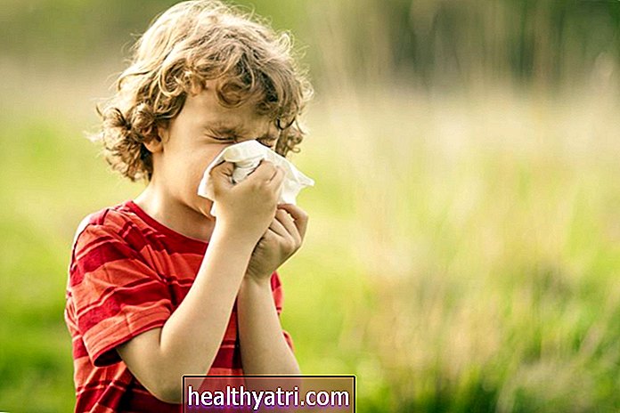 Kaip sužinoti, ar mano vaikas turi alergiją?