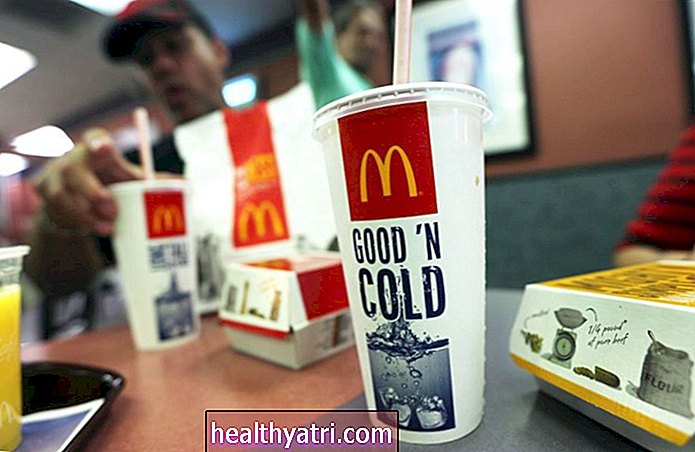 „McDonald's“ maisto alergijos informacija