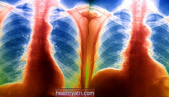 L'anatomie du diaphragme