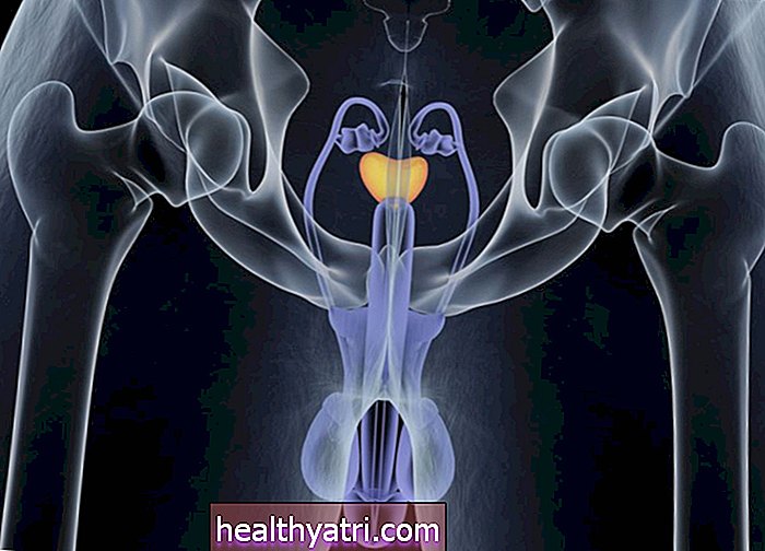 La anatomía de la próstata