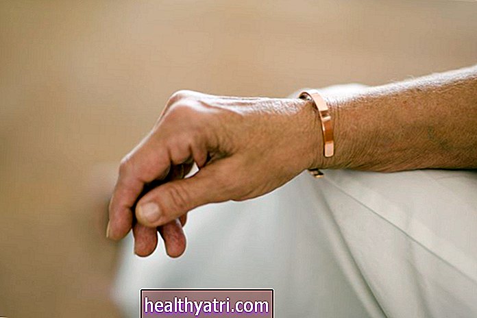 ¿Usar una pulsera de cobre puede aliviar el dolor de la artritis?
