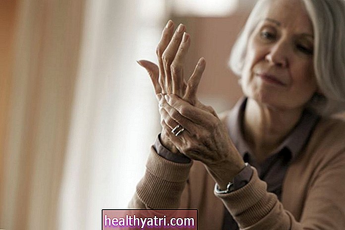 Adakah Makanan Tambahan Kolagen Menguntungkan Artritis?