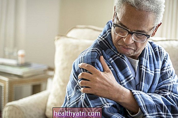 Factores que influyen en el dolor crónico de la artritis