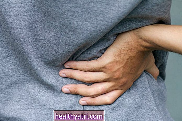 Kako se liječi artritis u leđima