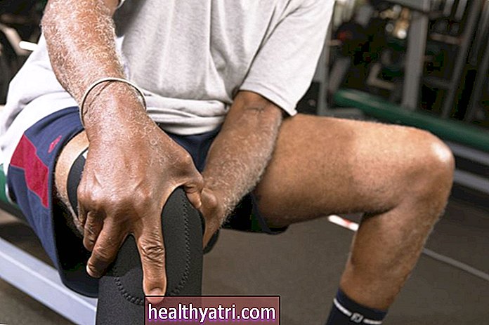 Ako môžu ortézy na kolená pomôcť bolestivej artróze kolena