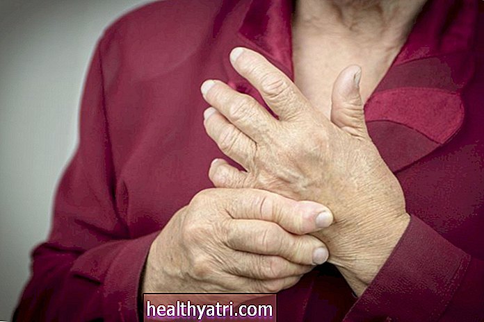 Cum se dezvoltă Pannus cu artrita