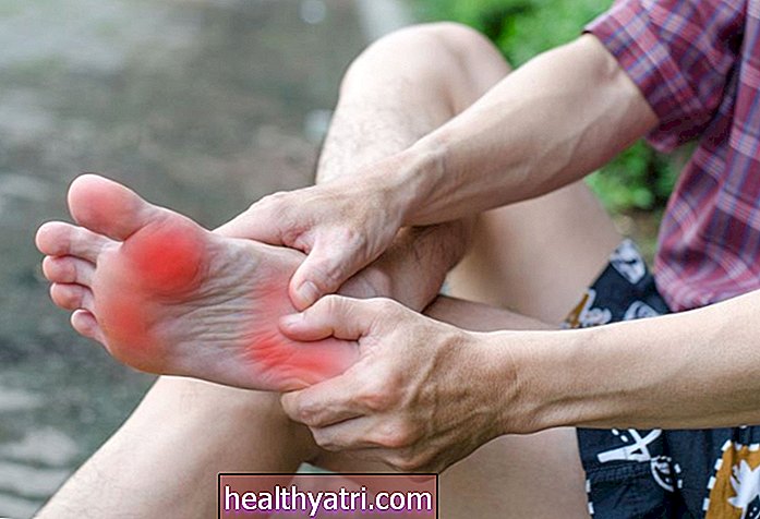 Kaip psoriazinis artritas veikia kojas