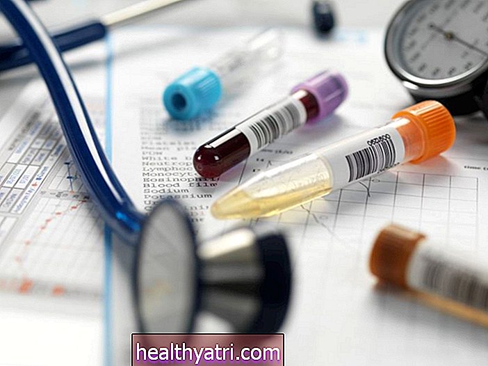 Hyperuricemia dan Penyakit Ginjal
