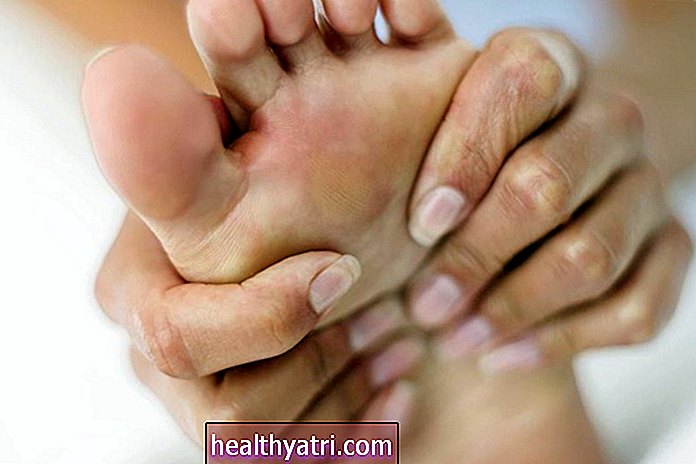 Біль у суглобах у ногах: Симптом ревматоїдного артриту