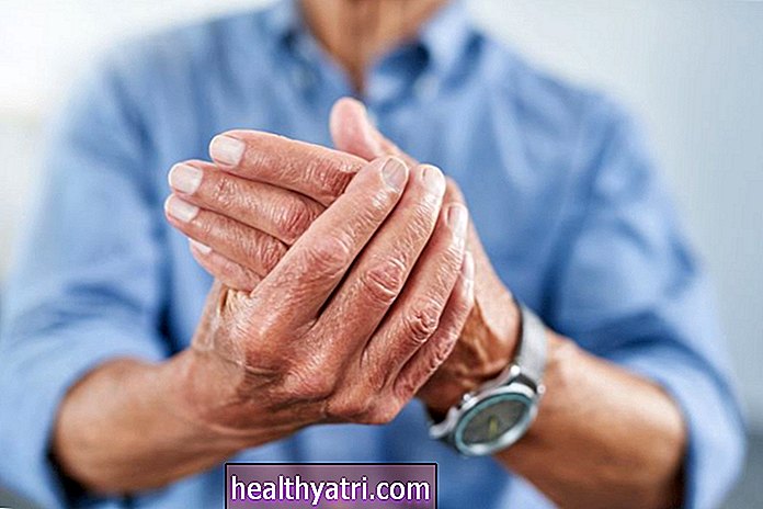 Prevencija artritisa u rukama