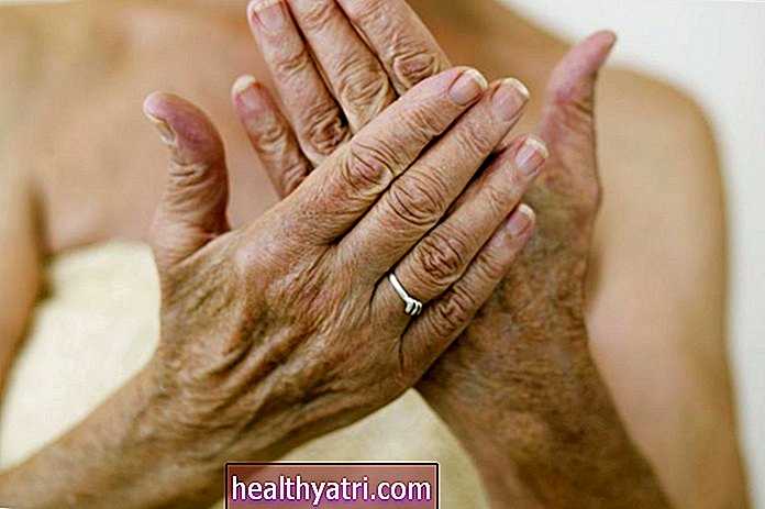 Cremas tópicas para aliviar el dolor de la artritis