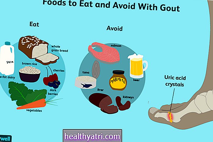 Makanan Apa Yang Harus Dielakkan Dengan Gout