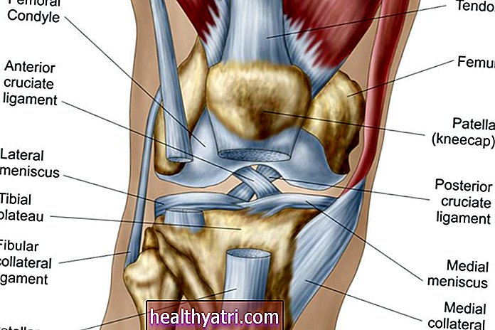 O que está causando sua dor no joelho?
