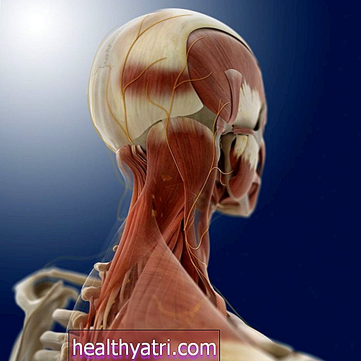 Qu'est-ce que la polyarthrite rhumatoïde dans le cou?