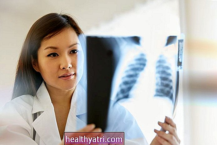 Krūtinės ląstos rentgeno vaidmuo tikrinant ir diagnozuojant astmą