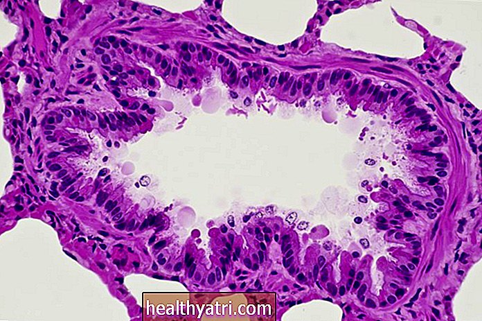 द पाथोप्सियोलॉजी ऑफ़ अस्थमा