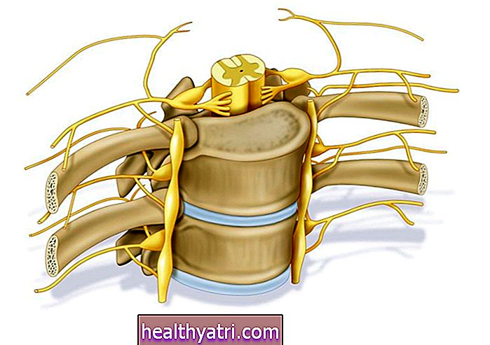Opredelitev korenin hrbtenjačnega živca