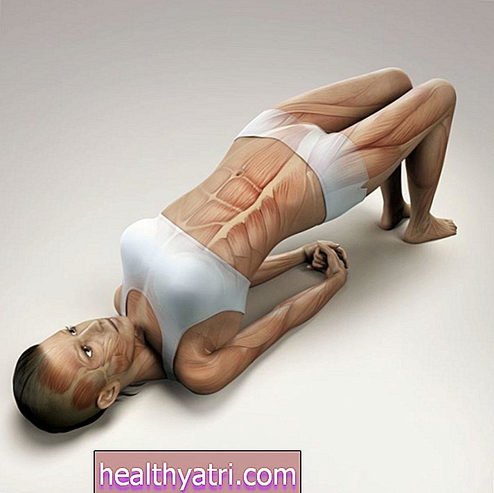 Atbalstītā tilta jogas poza muguras sāpēm