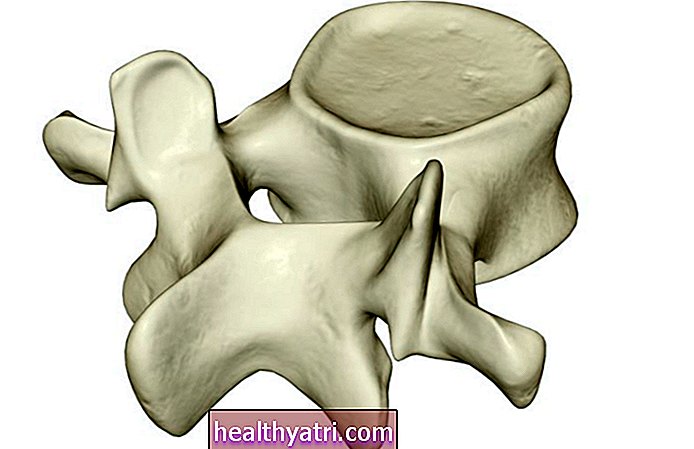 Zlomeniny vertebrálneho tela a zlomeniny chrbtice