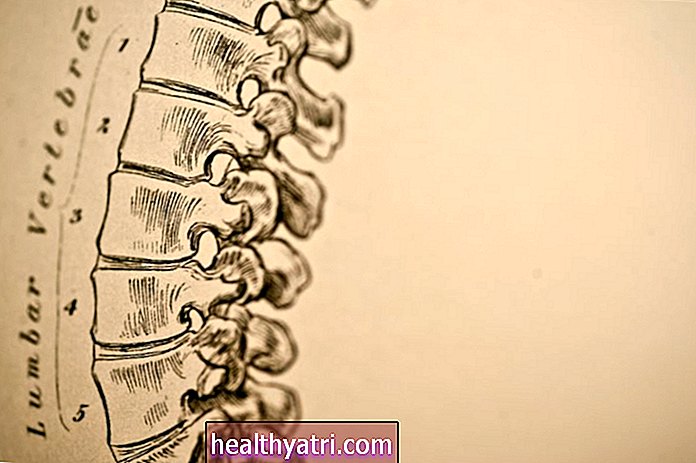 Miksi ristiselän selkäranka saattaa aiheuttaa selkäkipujasi