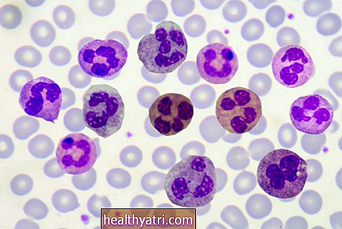 Polimorfonukleārās leikocītu baltās asins šūnas