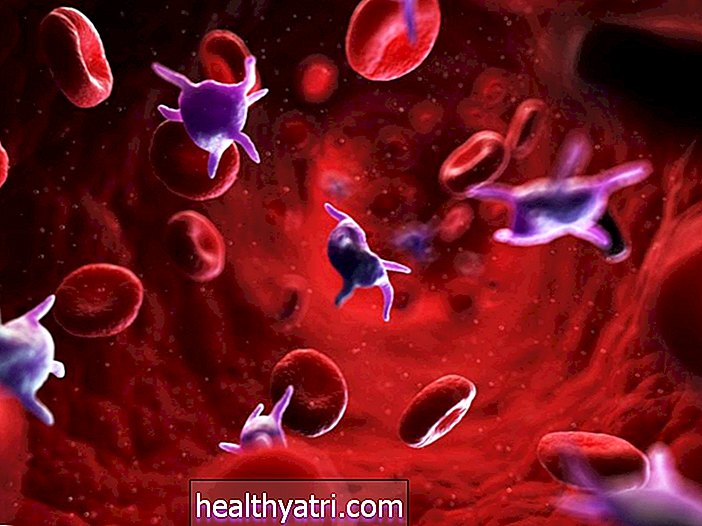 Was ist Immunthrombozytopenie?