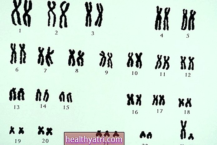 9 Zriedkavé genetické trizómie