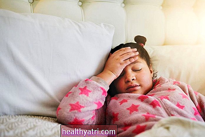 Pregled migrene u djece