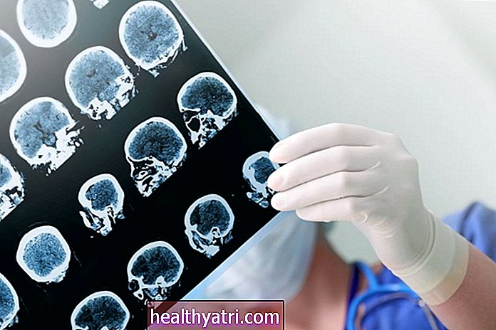 Види та причини ішемії мозку