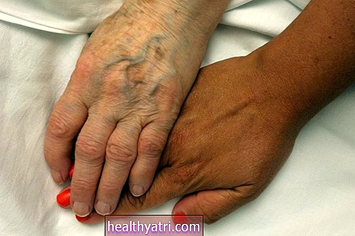 Alzheimeri tõvega inimeste surma põhjused