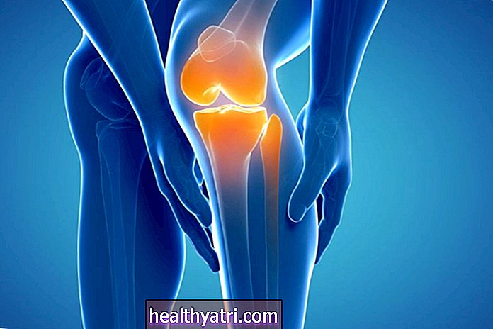 Болки в тазобедрената става и коляното при множествена склероза