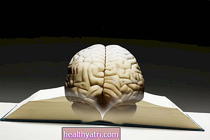 Kaip kognityvinis rezervas veikia Alzheimerio ligą? Liga