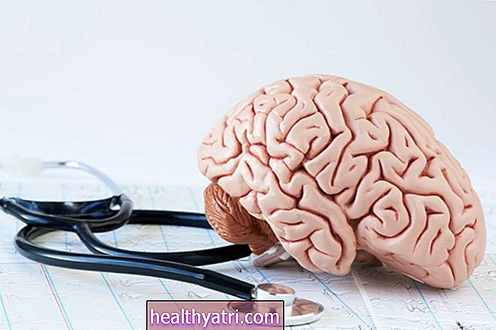 मस्तिष्क - तंत्रिका-प्रणाली - सेरिबैलम एमएस में कैसे प्रभावित होता है
