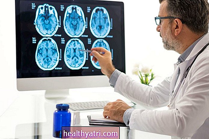 Ainutlaatuiset oireet, jotka perustuvat aivovaurioiden sijaintiin Alzheimerin taudissa