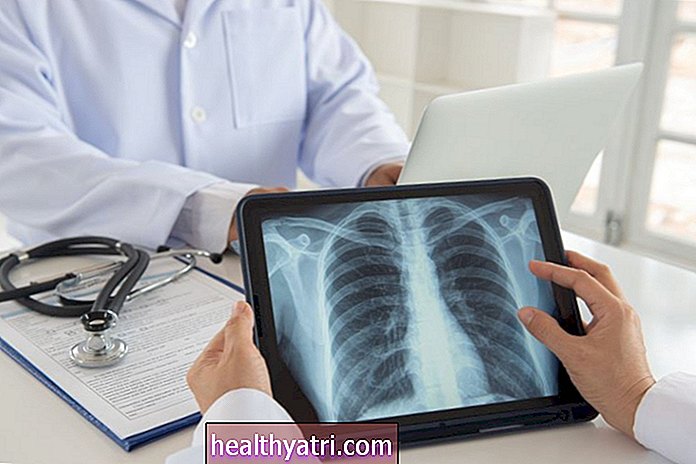 Idiopatinės plaučių fibrozės apžvalga