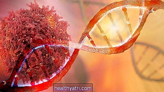 BRCA2 mutacije gena i rizik od raka kod muškaraca i žena