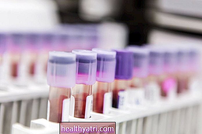Тести на маркери пухлин на рак молочної залози