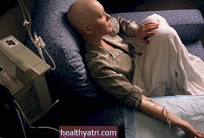 Chemoterapija sergant plaučių vėžiu