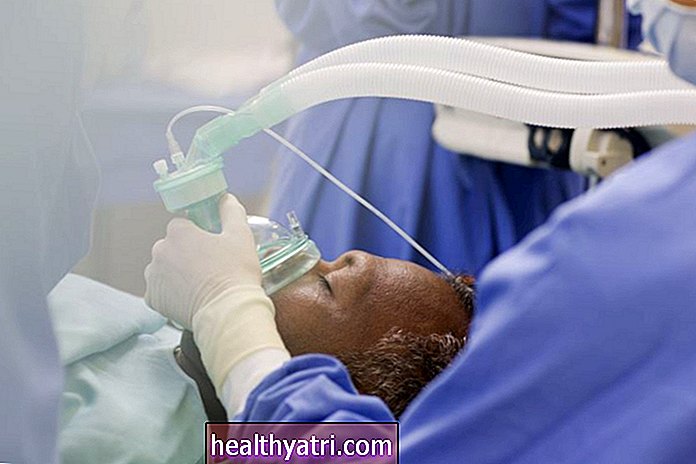 Påvirker anestesivalg Kolonkreftoverlevelse?