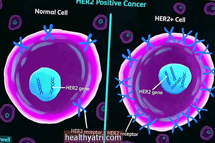 ХЕР2 тестирање на рак дојке
