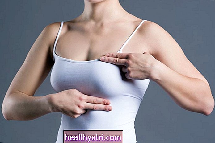 Како направити самопреглед дојки (БСЕ)