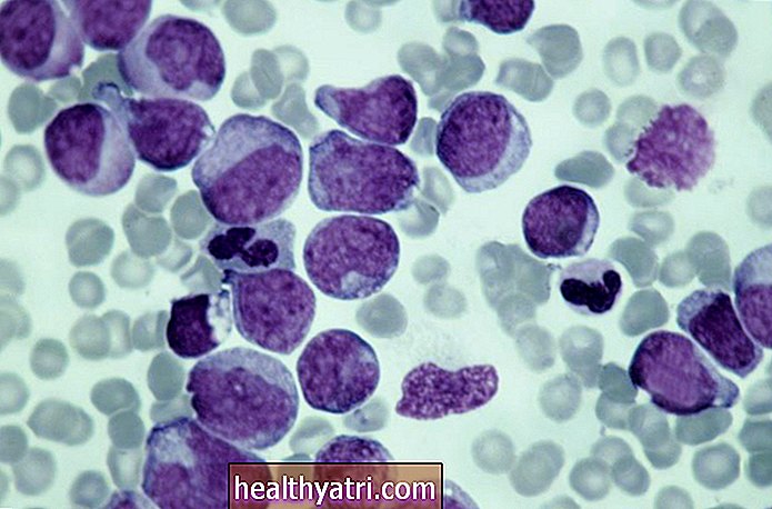 Pregled raka krvnih celic