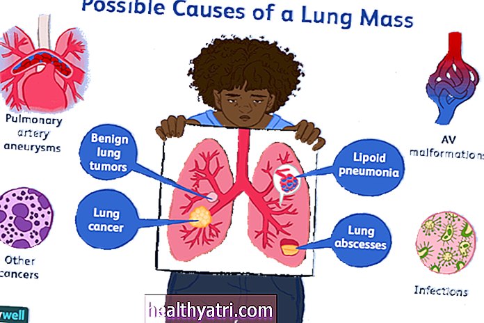 Iespējamie plaušu masas cēloņi