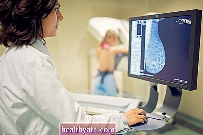 Cicatrices radiales y riesgo de cáncer de mama