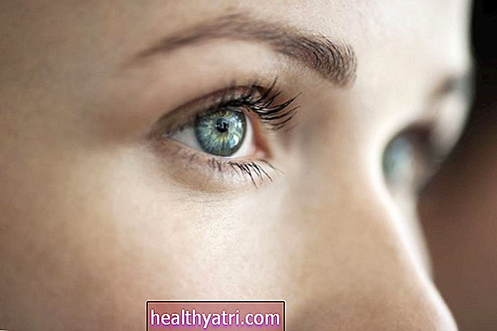 Akių vėžio požymiai ir simptomai