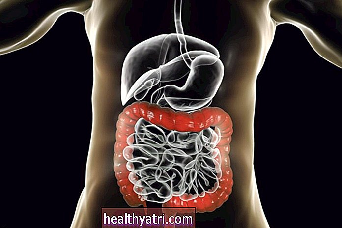 La anatomía del colon (intestino grueso)