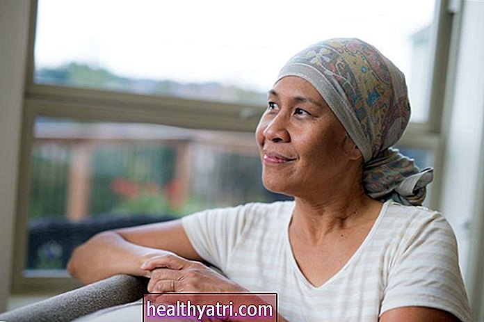 Lijekovi za kemoterapiju koji uzrokuju gubitak kose